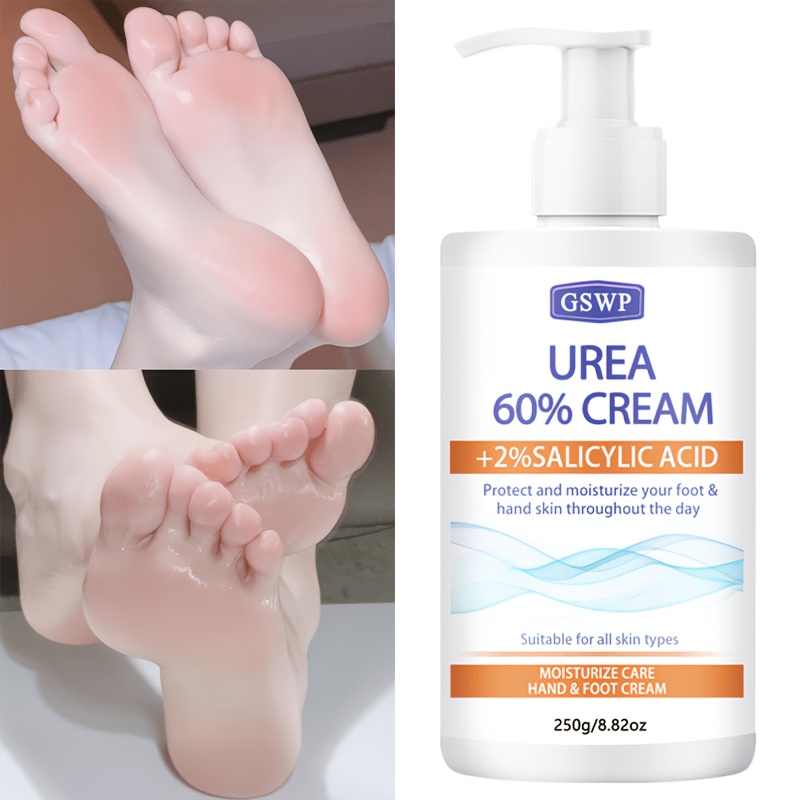 Azelaic Acid Cream - GSWP 60% Urea Moisturising Hand and