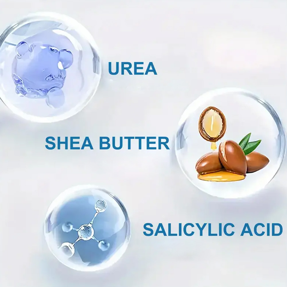 YOUNGCOME 250G Urea Cream with - Azelaic Acid Cream review and price