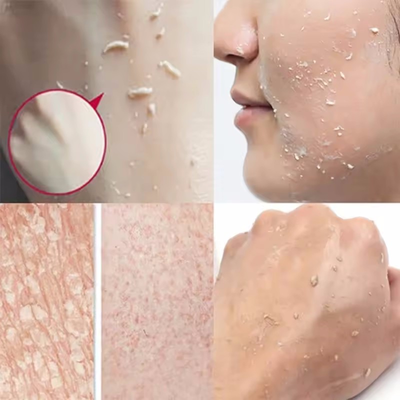 Orange Exfoliating Peeling Gel - Ceramide Moisturizer review and price