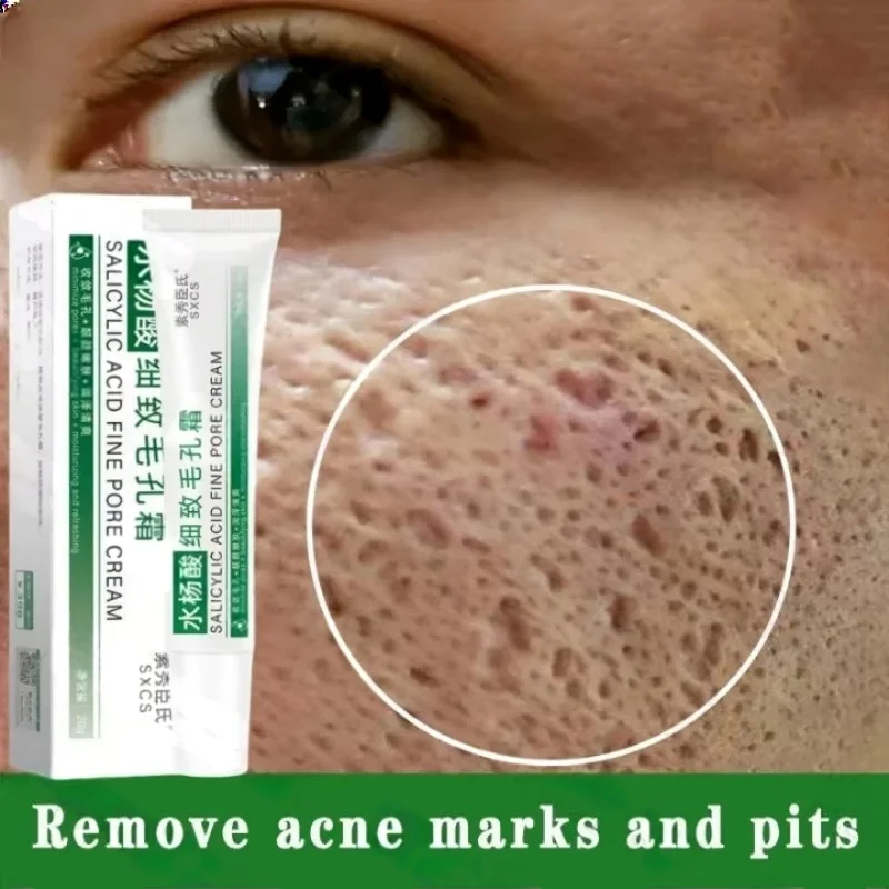Salicylic Acid Pore Clearing C - Azelaic Acid Cream review and price