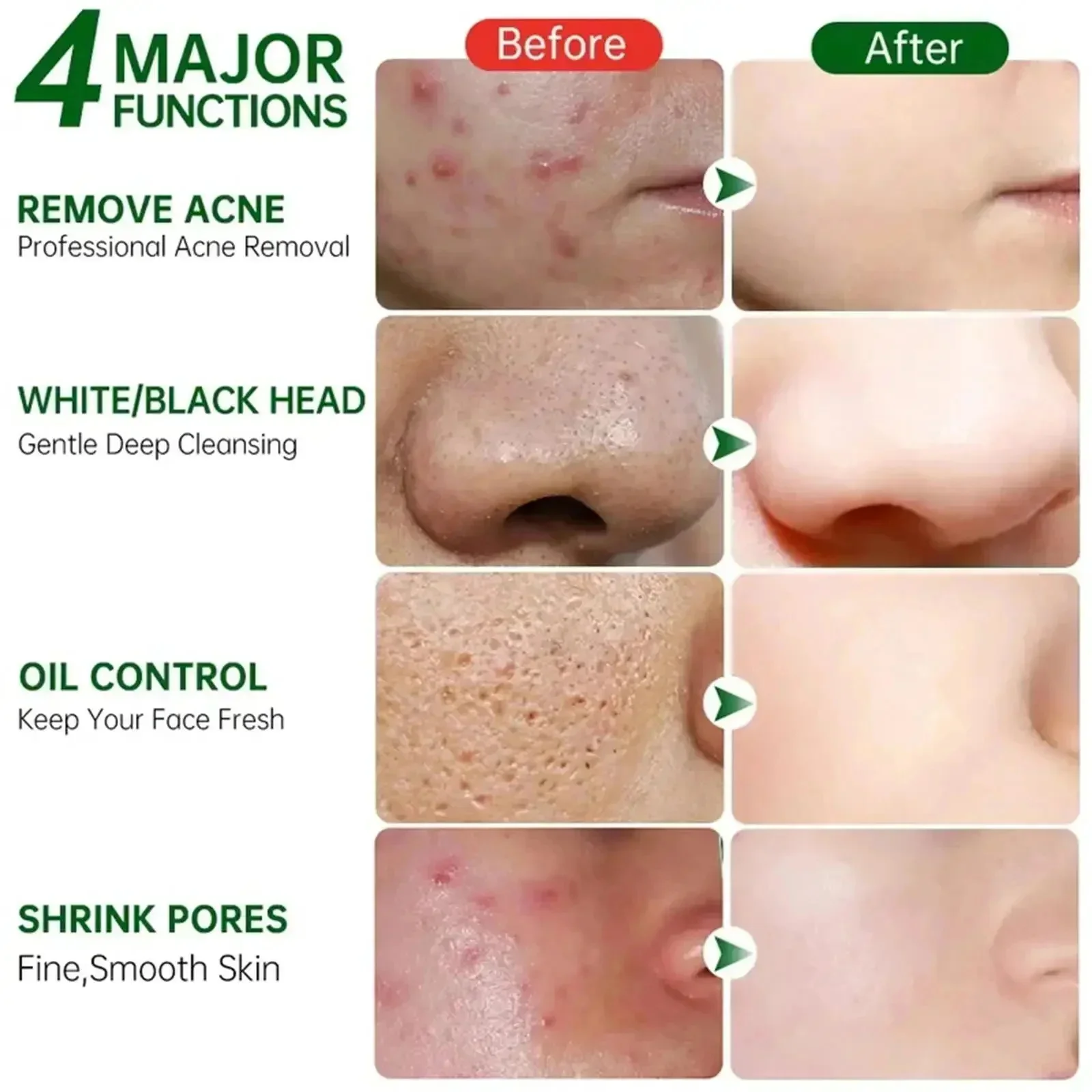 Salicylic Acid Pore Clearing C - Azelaic Acid Cream review and price