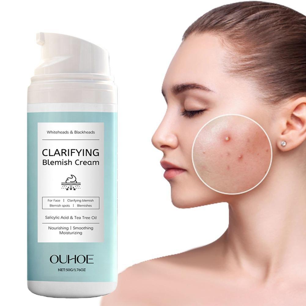 Salicylic Acid Facial Cream fo - Azelaic Acid Cream review and price