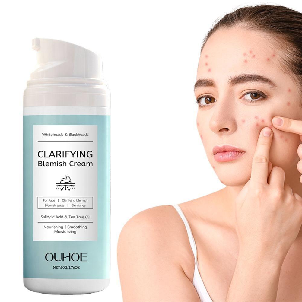 Salicylic Acid Facial Cream fo - Azelaic Acid Cream review and price