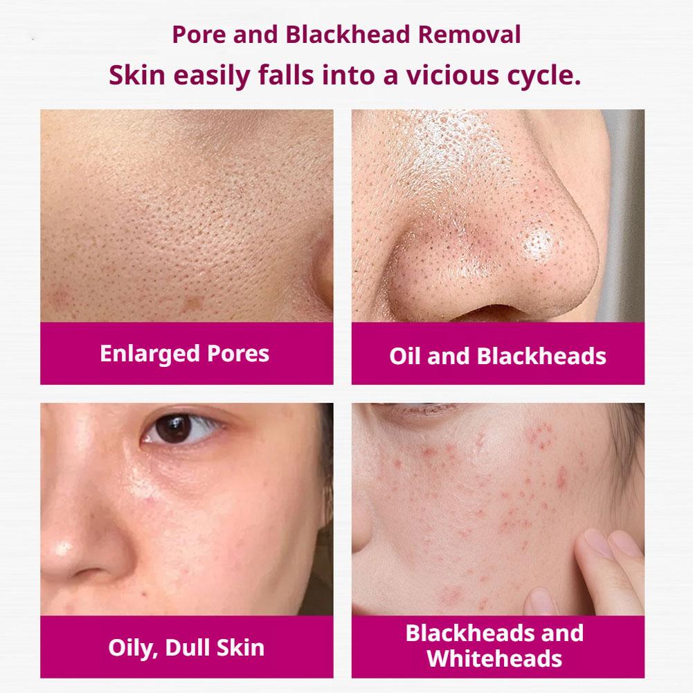 Salicylic Acid Shrink Pores Se - Skincare Skintific review and price