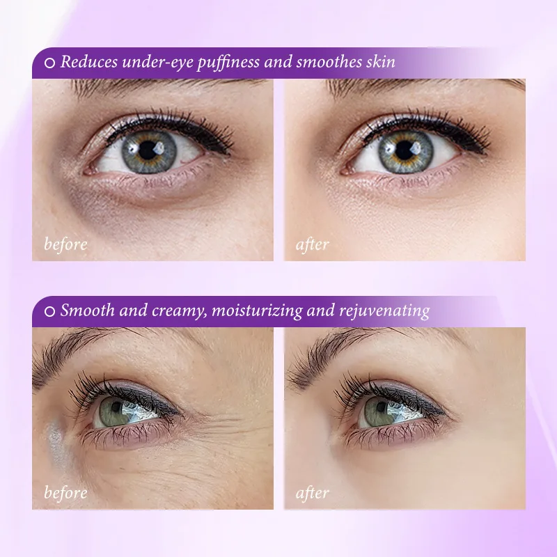Instant Eye Bag Removal Cream  - Skincare D'Alba review and price